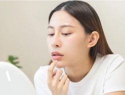 Cara Mengatasi Bibir Kering