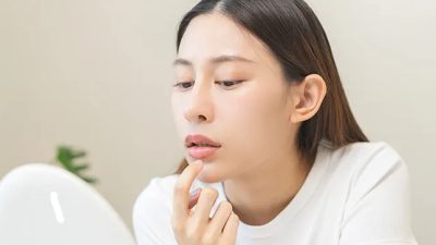 Bibir Kering